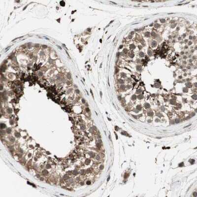 Immunohistochemistry-Paraffin: AKAP1 Antibody [NBP1-89172] - Staining of human testis shows strong cytoplasmic positivity in spermatids.