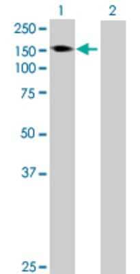 Western Blot: AKAP1 Antibody [H00008165-B01P] - Analysis of AKAP1 expression in transfected 293T cell line by AKAP1 polyclonal antibody.  Lane 1: AKAP1 transfected lysate(99.33 KDa). Lane 2: Non-transfected lysate.