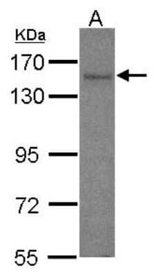 Western Blot: AKAP1 Antibody [NBP1-33629] - Sample (30 ug of whole cell lysate) A: IMR32 7.5% SDS PAGE; antibody diluted at 1:1000.