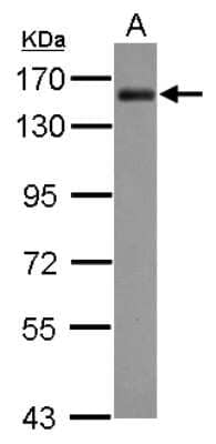 Western Blot: AKAP1 Antibody [NBP2-15319] - Sample (30 ug of whole cell lysate) A: HeLa 7. 5% SDS PAGE; antibody diluted at 1:10000.