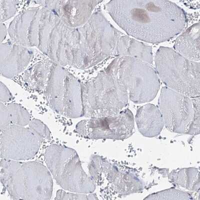 Immunohistochemistry-Paraffin: AKAP11 Antibody [NBP1-89169] - Staining of human skeletal muscle shows low expression as expected.