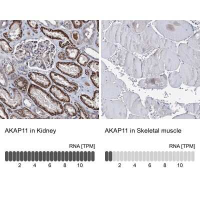 Immunohistochemistry-Paraffin: AKAP11 Antibody [NBP1-89169] - Staining in human kidney and skeletal muscle tissues using anti-AKAP11 antibody. Corresponding AKAP11 RNA-seq data are presented for the same tissues.