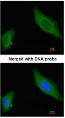 Immunocytochemistry/Immunofluorescence: AKAP12 Antibody [NBP1-31482] - Paraformaldehyde-fixed HeLa, using antibody at 1:200 dilution.