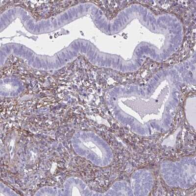 Immunohistochemistry-Paraffin: AKAP12 Antibody [NBP2-38786] - Staining of human endometrium shows  moderate positivity in stromal cells.