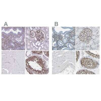 <b>Independent Antibodies Validation. </b>Immunohistochemistry-Paraffin: AKAP12 Antibody [NBP2-38786] - Staining of human endometrium, kidney, skeletal muscle and testis using Anti-AKAP12 antibody NBP2-38786 (A) shows similar protein distribution across tissues to independent antibody NBP1-89168 (B).