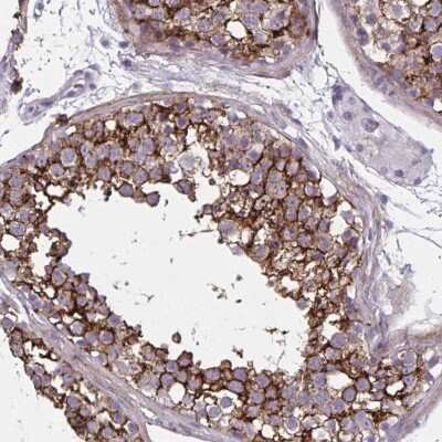 Immunohistochemistry-Paraffin: AKAP12 Antibody [NBP2-38786] - Staining of human testis shows strong membranous positivity in cells in seminiferous ducts.