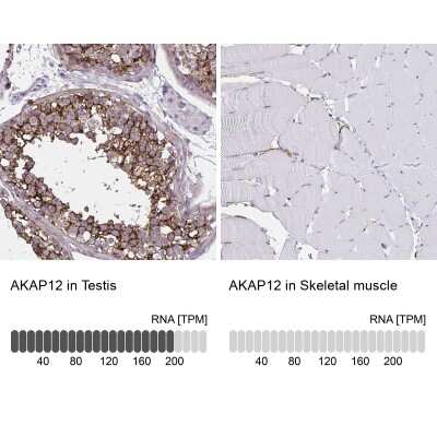 <b>Orthogonal Strategies Validation. </b>Immunohistochemistry-Paraffin: AKAP12 Antibody [NBP2-38786] - Staining in human testis and skeletal muscle tissues using NBP2-38786 antibody. Corresponding AKAP12 RNA-seq data are presented for the same tissues.