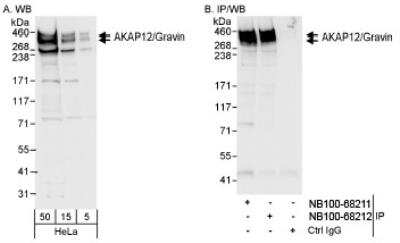 Western Blot: AKAP12 Antibody [NB100-68211] - Detection of Human AKAP12/Gravin on HeLa whole cell lysate using NB100-68211.  AKAP12/Gravin  was also immunoprecipitated by rabbit anti-AKAP12/Gravin  antibody NB100-68212.