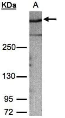 Western Blot: AKAP12 Antibody [NBP1-31482] - Sample (30ug whole cell lysate) A:HeLa S3 5% SDS PAGE, antibody diluted at 1:1000.