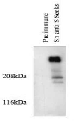 Western Blot: AKAP12 Antibody [NBP2-66604] - Western blotting of total cellular protein from cultured rat aortic smooth muscle cells was prepared and analyzed. The protein was transferred to a PVDF membrane, blocked with 1X TBS, 0.1% Tween 20/ 5% NFDM, probed with 5 ug/mL of pre-immune serum 5 ug of AKAP12 antibody (a 3 second exposure is shown). The blot was then washed and probed with monoclonal anti-sheep IgG coupled to HRP at 1:10000, and detected with luminol.