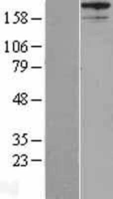 Western Blot: AKAP12 Overexpression Lysate (Adult Normal) [NBL1-07426] Left-Empty vector transfected control cell lysate (HEK293 cell lysate); Right -Over-expression Lysate for AKAP12.