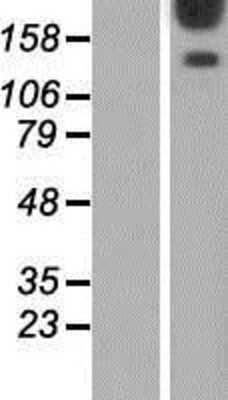 Western Blot: AKAP12 Overexpression Lysate (Adult Normal) [NBP2-07793] Left-Empty vector transfected control cell lysate (HEK293 cell lysate); Right -Over-expression Lysate for AKAP12.