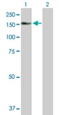 Western Blot: AKAP13 Antibody [H00011214-D01P] - Analysis of AKAP13 expression in transfected 293T cell line by AKAP13 polyclonal antibody.Lane 1: AKAP13 transfected lysate(120.20 KDa).Lane 2: Non-transfected lysate.
