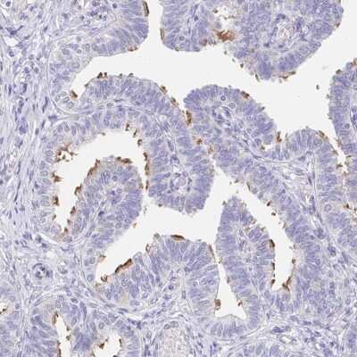 Immunohistochemistry-Paraffin: AKAP14 Antibody [NBP2-32580] - Staining of human fallopian tube shows high expression.