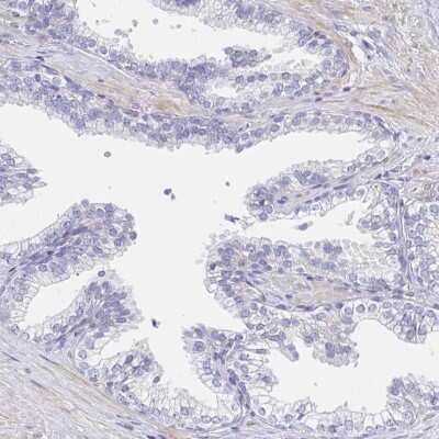 <b>Orthogonal Strategies Validation. </b>Immunohistochemistry-Paraffin: AKAP14 Antibody [NBP2-32580] - Staining of human prostate shows low expression as expected.