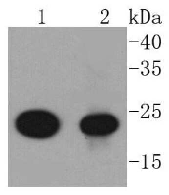 Western Blot: AKAP14 Antibody (SC0667) [NBP2-67620] - Analysis of AKAP14 on different lysates using anti-AKAP14 antibody at 1/1,000 dilution. Positive control: Lane 1: Jurkat Lane 2: A549