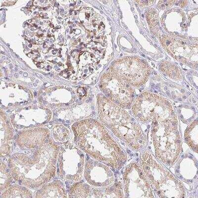 Immunohistochemistry-Paraffin AKAP2 Antibody - BSA Free