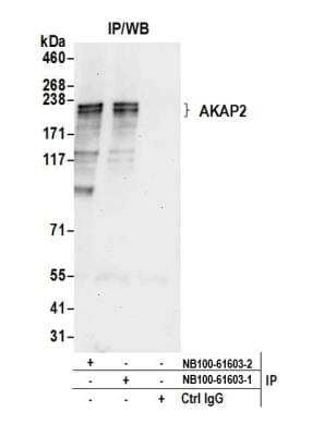 Immunoprecipitation: AKAP2 Antibody [NB100-61603] - Detection of human AKAP2 by western blot of immunoprecipitates. Samples: Whole cell lysate (0.5 or 1.0 mg per IP reaction; 20% of IP loaded) from HeLa cells prepared using NETN lysis buffer. Antibodies: Affinity purified rabbit anti-AKAP2 antibody NB100-61603 (lot 2) used for IP at 6 ug per reaction. AKAP2 was also immunoprecipitated by a previous lot of this antibody (lot 1). For blotting immunoprecipitated AKAP2, NB100-61603 was used at 0.1 ug/ml. Detection: Chemiluminescence with an exposure time of 30 seconds.