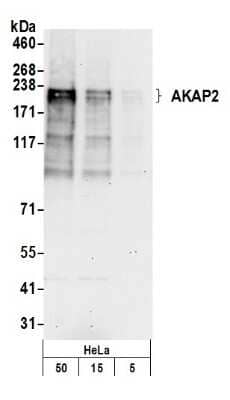 Western Blot AKAP2 Antibody