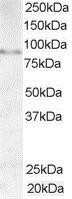 Western Blot AKAP3 Antibody