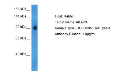 Western Blot: AKAP3 Antibody [NBP2-84413] - Host: Rabbit. Target Name: AKAP3. Sample Tissue: Human COLO205 Whole Cell. Antibody Dilution: 1.0ug/ml