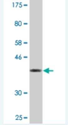 Western Blot AKAP6 Antibody (2E8)