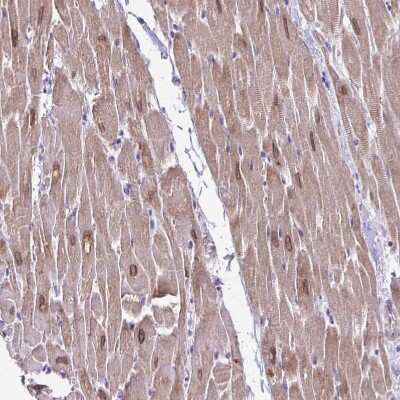 Immunohistochemistry-Paraffin AKAP6 Antibody