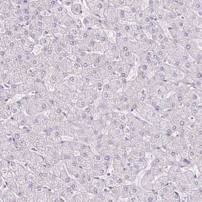 Immunohistochemistry-Paraffin AKAP6 Antibody