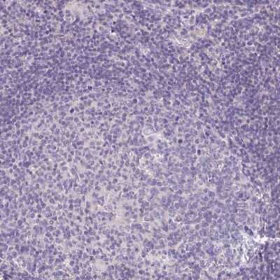 Immunohistochemistry-Paraffin AKAP6 Antibody