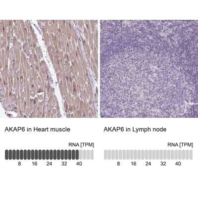 Immunohistochemistry-Paraffin: AKAP6 Antibody [NBP2-38590] - Analysis in human heart muscle and lymph node tissues using NBP2-38590 antibody. Corresponding AKAP6 RNA-seq data are presented for the same tissues.