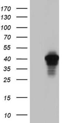 Western Blot: AKAP7 Antibody (6F7) [NBP2-46504] - Analysis of HEK293T cells were transfected with the pCMV6-ENTRY control (Left lane) or pCMV6-ENTRY AKAP7.