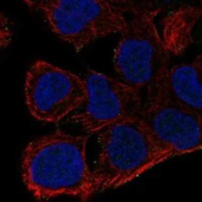 Immunocytochemistry/Immunofluorescence: AKAP7 Antibody [NBP3-17649] - Staining of human cell line RT4 shows localization to vesicles.