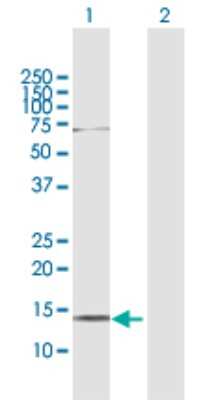 Western Blot: AKAP7 Antibody [H00009465-D01P] - Analysis of AKAP7 expression in transfected 293T cell line by AKAP7 polyclonal antibody.Lane 1: AKAP7 transfected lysate(11.50 KDa).Lane 2: Non-transfected lysate.