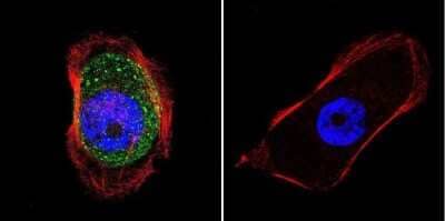 Immunocytochemistry/Immunofluorescence: AKAP9 Antibody (17G10) [NB100-74351] - Analysis of AKAP450 in A431 cells. Cells were grown on chamber slides and fixed with formaldehyde prior to staining. Cells were probed without (control) or with a AKAP450 monoclonal antibody at a dilution of 1:100 overnight at 4C, washed with PBS and incubated with a DyLight-488 conjugated secondary antibody. AKAP450 staining (green), F-Actin staining with Phalloidin (red) and nuclei with DAPI (blue) is shown.