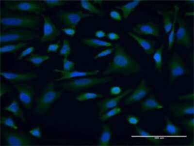Immunocytochemistry/Immunofluorescence: AKAP9 Antibody (7E12) [H00010142-M07] - Analysis of monoclonal antibody to AKAP9 on HeLa cell. Antibody concentration 10 ug/ml