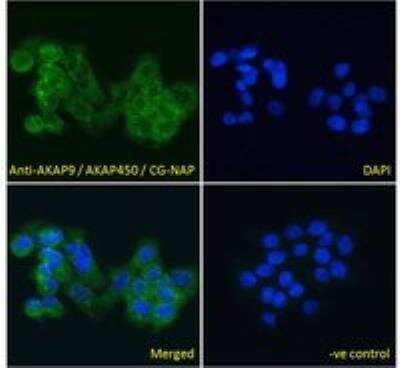 Immunocytochemistry/Immunofluorescence: AKAP9 Antibody [NB100-1517] -  analysis of paraformaldehyde fixed A431 cells, permeabilized with 0.15% Triton. Primary incubation 1hr (10ug/ml) followed by Alexa Fluor 488 secondary antibody (4ug/ml), showing cytoplasmic and Golgi apparatus staining. The nuclear stain is DAPI (blue). Negative control: Unimmunized goat IgG (10ug/ml) followed by Alexa Fluor 488 secondary antibody (4ug/ml).