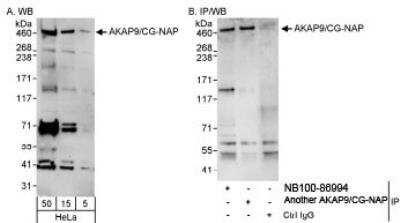Western Blot: AKAP9 Antibody [NB100-86994] - Detection of Human AKAP9/CG-NAP on HeLa whole cell lysate using NB100-86994. AKAP9/CGNAP  was also immunoprecipitated by another rabbit anti-AKAP9/CGNAP  antibody.