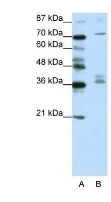 Western Blot: AKAP9 Antibody [NBP1-80308] - Titration: 1.25ug/ml, Positive Control: Jurkat cell lysate.