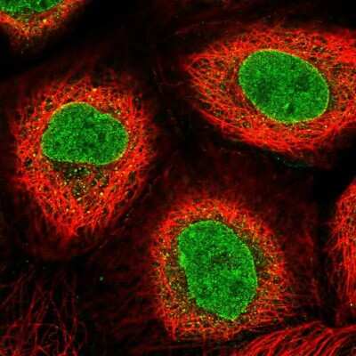 Immunocytochemistry/Immunofluorescence: AKD1 Antibody [NBP2-33936] - Staining of human cell line A-431 shows localization to nucleoplasm & nuclear membrane. Antibody staining is shown in green.