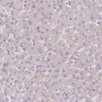 Immunohistochemistry-Paraffin: AKD1 Antibody [NBP2-34033] - Staining of human liver shows low expression as expected.