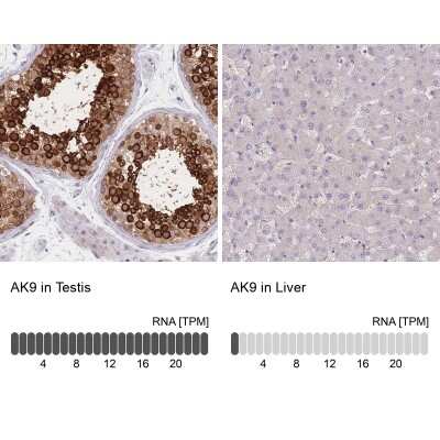 <b>Orthogonal Strategies Validation. </b>Immunohistochemistry-Paraffin: AKD1 Antibody [NBP2-34033] - Staining in human testis and liver tissues using anti-AK9 antibody. Corresponding AK9 RNA-seq data are presented for the same tissues.