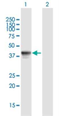 Western Blot: AKD1 Antibody [H00401271-B01P-50ug] -  analysis of FLJ42177 expression in transfected 293T cell line (H00401271-T01) by FLJ42177 MaxPab polyclonal antibody.Lane 1: FLJ42177 transfected lysate(36.96 KDa).Lane 2: Non-transfected lysate.