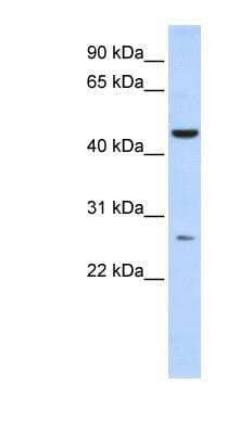 Western Blot: AKD1 Antibody [NBP1-56395] - Human Liver cell lysate, concentration 0.2-1 ug/ml.