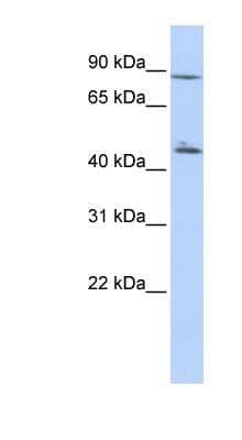 Western Blot: AKD1 Antibody [NBP1-56791] - Titration: 0.2-1 ug/ml, Positive Control: HepG2 cell lysate.