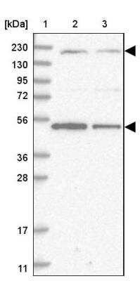 Western Blot: AKD1 Antibody [NBP2-33936] - Lane 1: Marker  [kDa] 230, 130, 95, 72, 56, 36, 28, 17, 11.  Lane 2: Human cell line RT-4.  Lane 3: Human cell line U-251MG sp