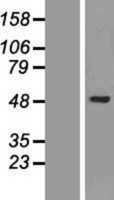 Western Blot: AKD1 Overexpression Lysate (Adult Normal) [NBL1-08523] Left-Empty vector transfected control cell lysate (HEK293 cell lysate); Right -Over-expression Lysate for AKD1.
