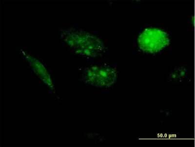 Immunocytochemistry/Immunofluorescence: AKIP Antibody [H00054998-B01P] - Analysis of purified antibody to AURKAIP1 on HeLa cell. (antibody concentration 10 ug/ml)