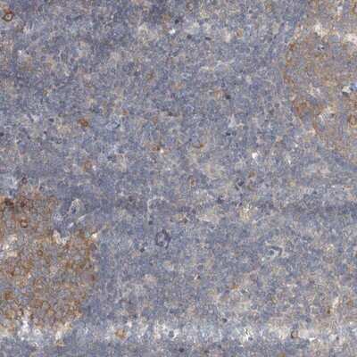 Immunohistochemistry-Paraffin: AKNAD1 Antibody [NBP1-90703] - Staining of human lymph node shows moderate cytoplasmic positivity in reactions center cells and in a fraction of cells outside the reaction center.