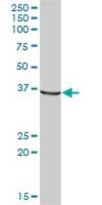 Western Blot: AKR1A1 Antibody [H00010327-B01P] - Analysis of AKR1A1 expression in human liver.