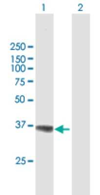 Western Blot: AKR1A1 Antibody [H00010327-B01P] - Analysis of AKR1A1 expression in transfected 293T cell line by AKR1A1 polyclonal antibody.  Lane 1: AKR1A1 transfected lysate(35.75 KDa). Lane 2: Non-transfected lysate.